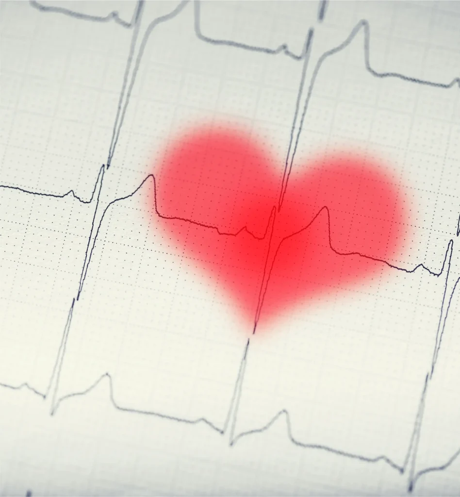 Effective Treatment Options for Heart Palpitations at Our Clinic