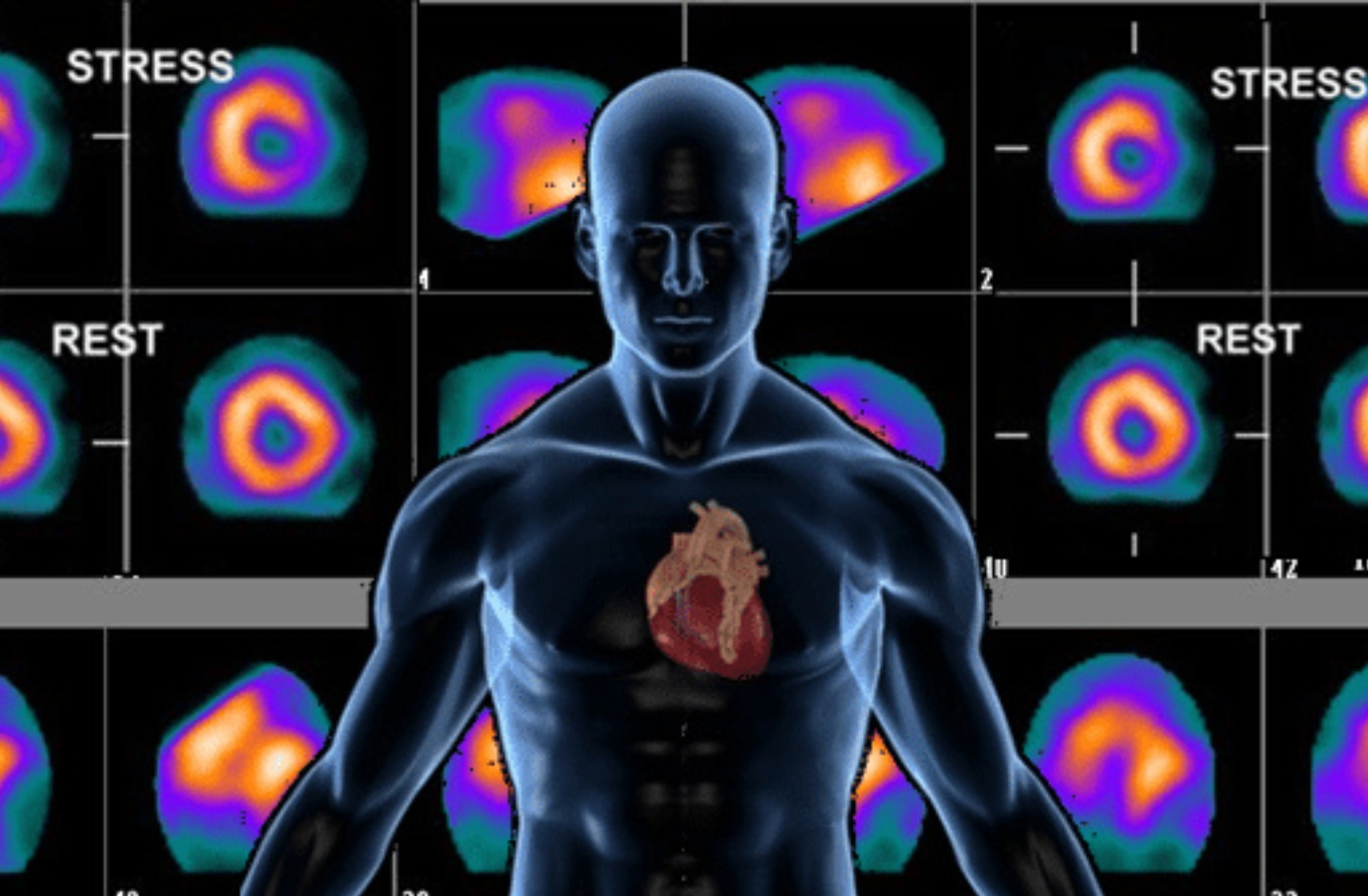 Understanding Nuclear Stress Tests