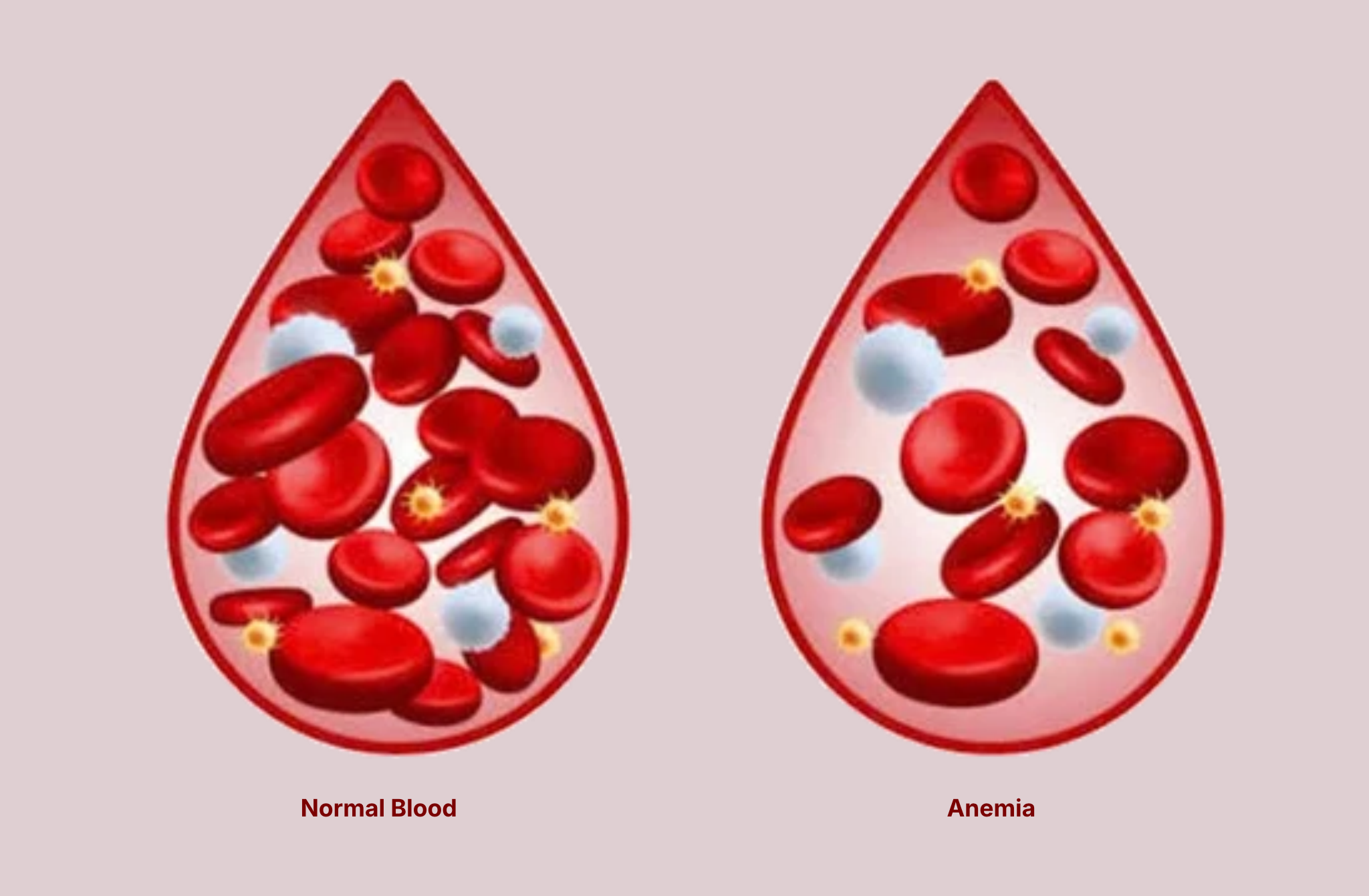 Can Anemia Cause Heart Palpitations
